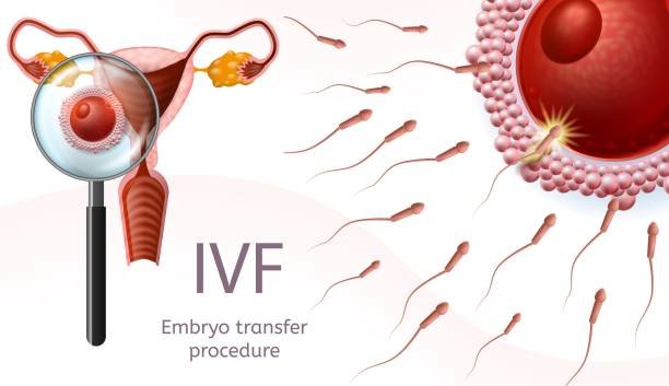 The procedure of Embryo transfer