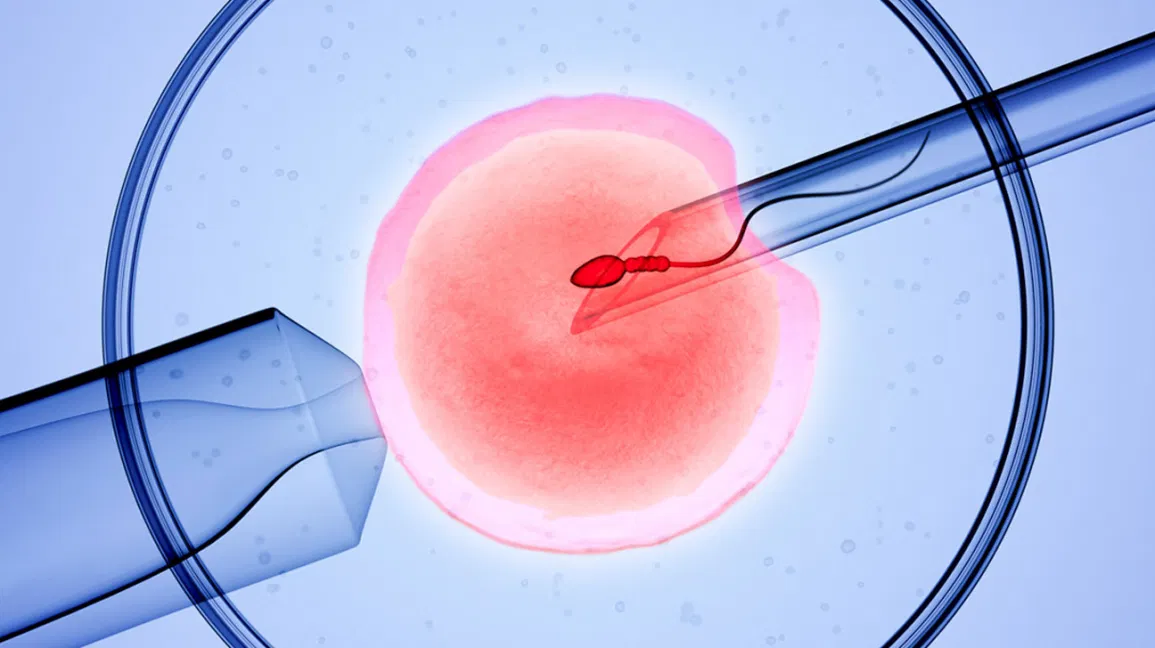 Why Does IUI Fail?