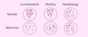 semen analysis