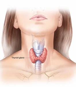 Thyroid Symptoms in Women