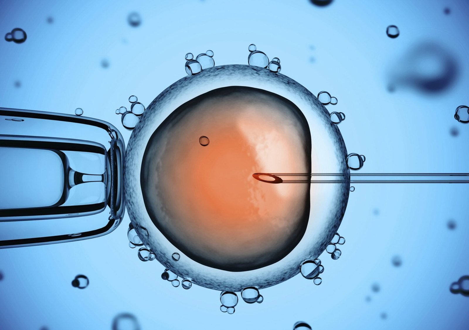 Intracytoplasmic Sperm injection procedure