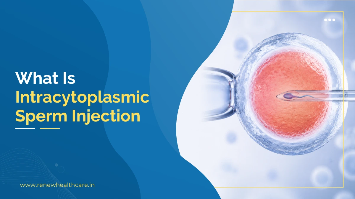 what-is-intracytoplasmic-sperm-injection