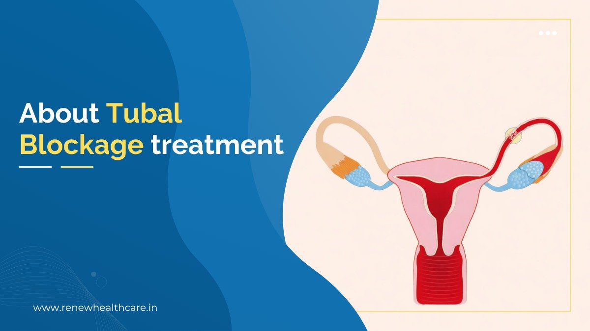 Tubal Blockage Treatment