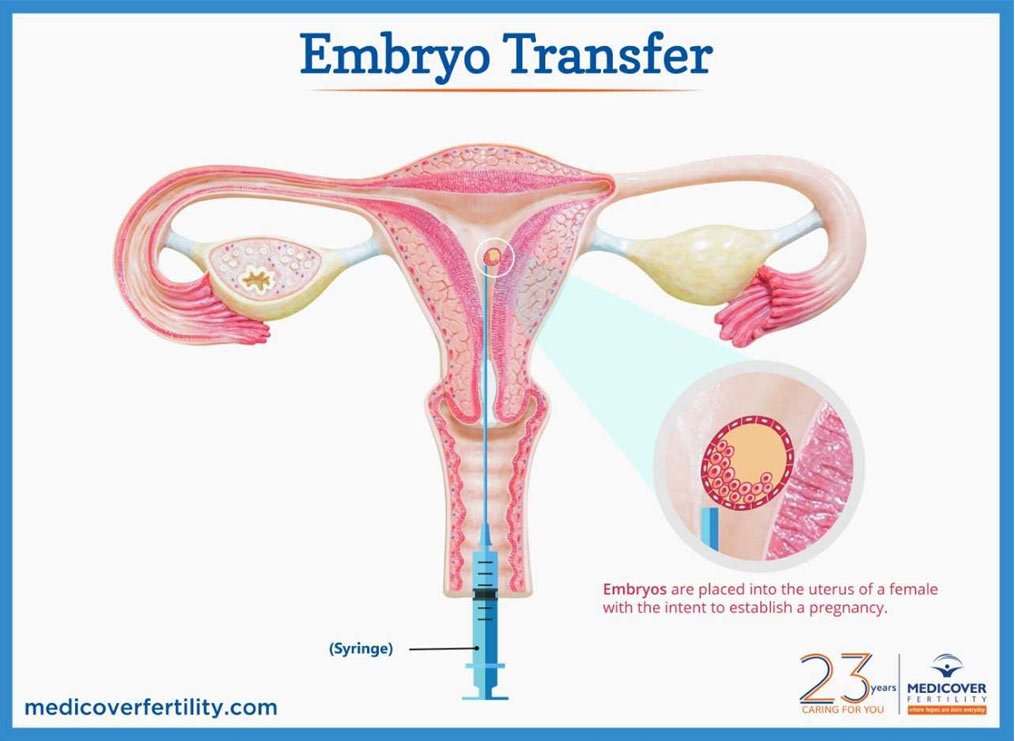 foods to avoid after embryo transfer