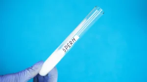 Sperm-Extraction-Procedure-In-Azoospermia