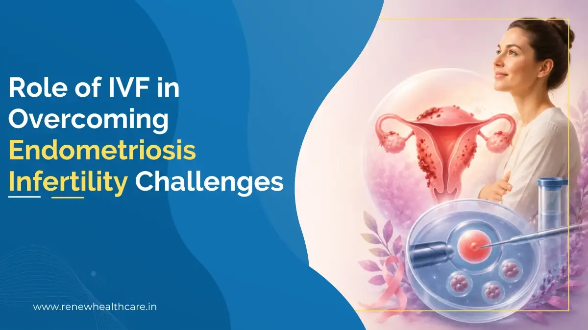 Role of IVF in Overcoming Endometriosis Infertility Challenges