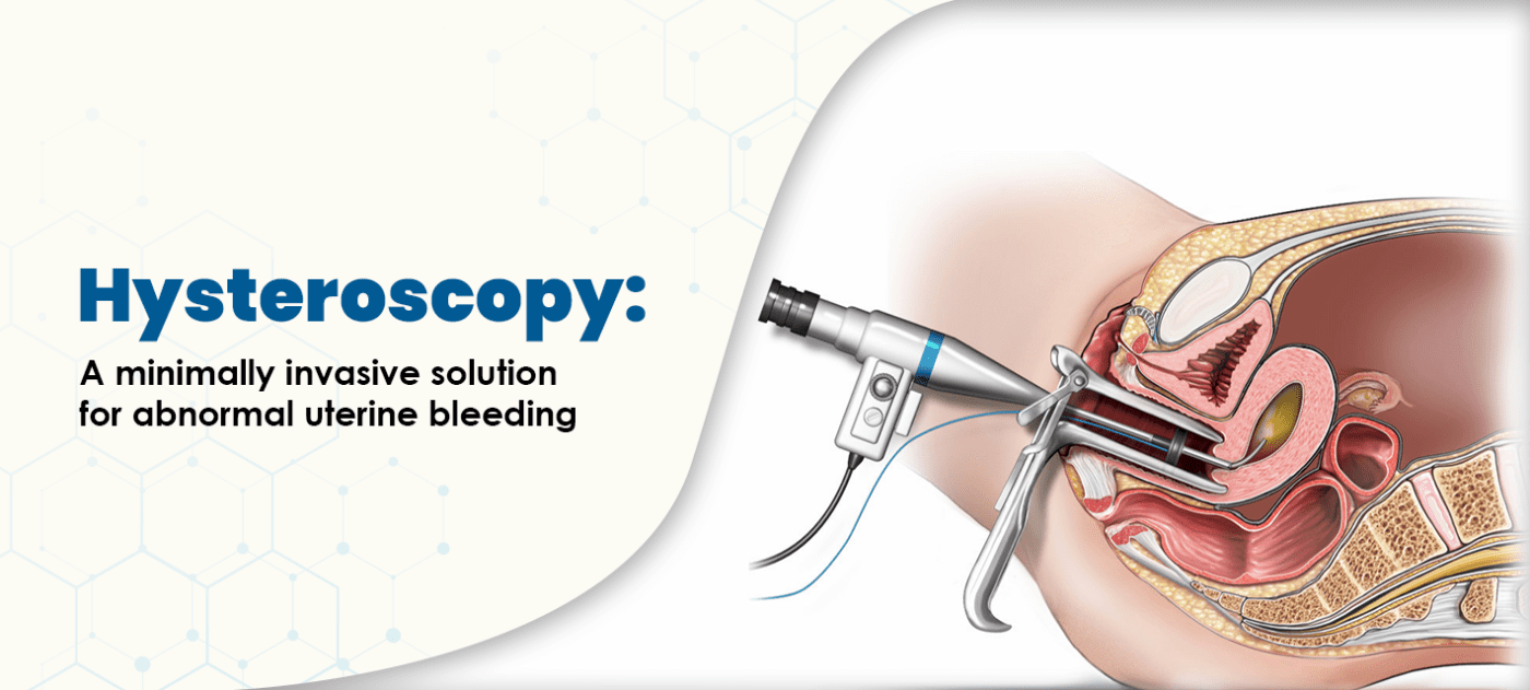 JRB Medical Centre - Postmenopausal bleeding is not normal and 90% of  endometrial cancers present with bleeding. Hysteroscopy has the advantage  to visualise the uterine cavity unlike a blind biopsy which is