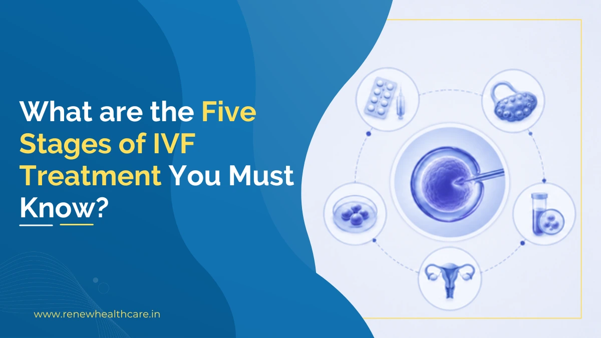 Five Stages of IVF Treatment