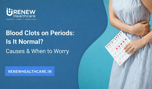 period-blood-clots-normal-causes-heavy-periods