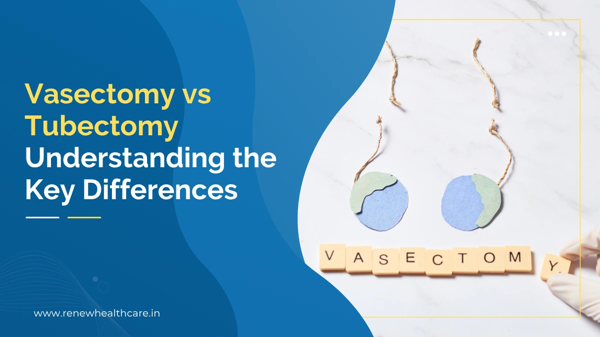 Vasectomy vs Tubectomy