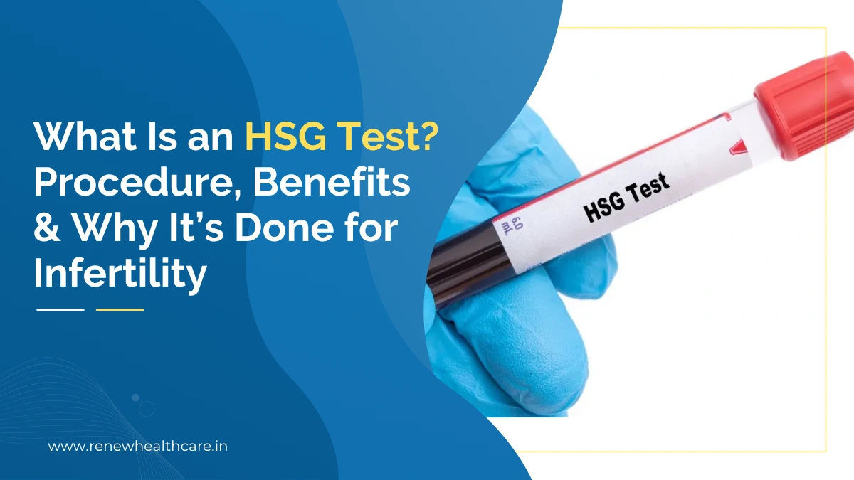 What Is an HSG Test