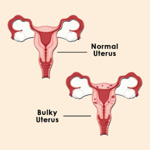 diagnostic laparoscopy