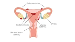 Endometrium
